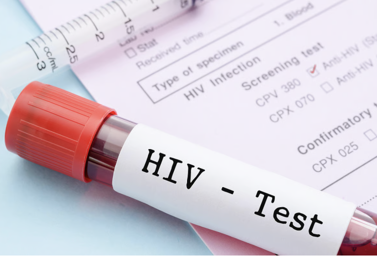 hiv